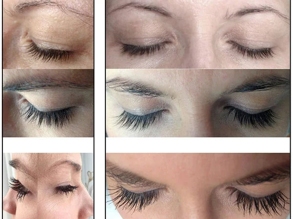 M2Lashes Eyelash Activating Serum 5ml & M2Beaute Gift Box - Most Powerful Eyelash Growth Serum, Based on The Proven and Eff