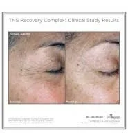 SkinMedica TNS Recovery Complex - 0.63 oz bottle